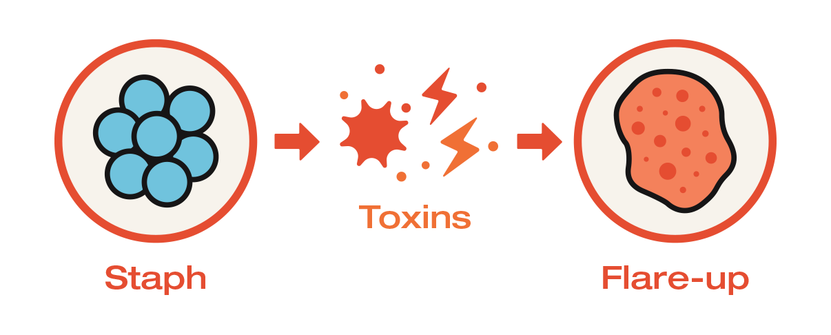 Diagram showing the progression from staph bacteria to toxins and then to a flare-up.