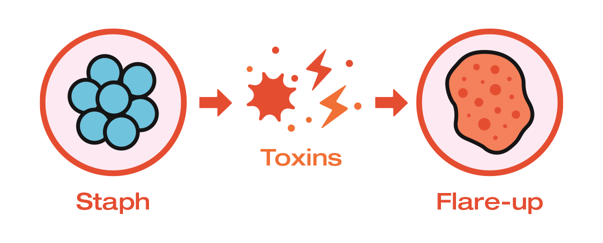 Diagram showing the progression from staph bacteria to toxins and then to a flare-up.