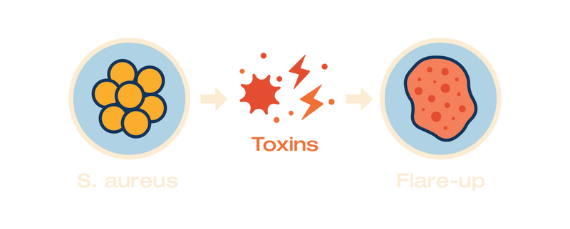 Diagram showing St.aphorius, toxins, and flare-up with icons and text on a white background.