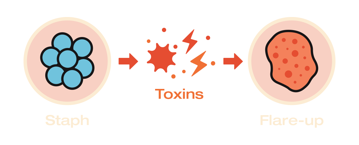 Diagram showing the progression from staph to toxins to flare-up.